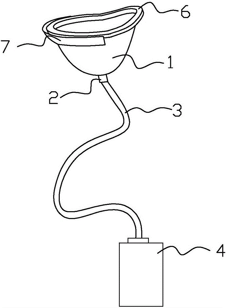 女性接尿器的制造方法附图